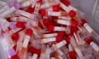 Most teenagers recover from long Covid after two years, study shows