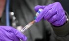 World may be ‘post-herd immunity’ to measles, top US scientist says