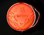 Superbugs could kill millions more and cost $2tn a year by 2050, models show