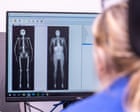 Full-body scans of 100,000 people could change way diseases are detected and treated