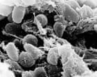 California resident tests positive for the plague after camping, officials say