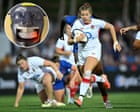 Flashing mouthgards for concussion to be introduced at Women’s Rugby World Cup