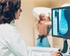Women who miss first breast cancer screening at ‘40% higher risk’ of dying from the disease