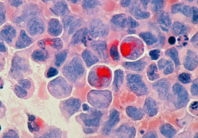 Google and Yale's new AI just made a major cancer discovery