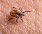Why is ‘chronic’ lyme disease so controversial? – podcast
