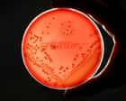Deaths linked to antibiotic-resistant superbugs rose 17% in England in 2024