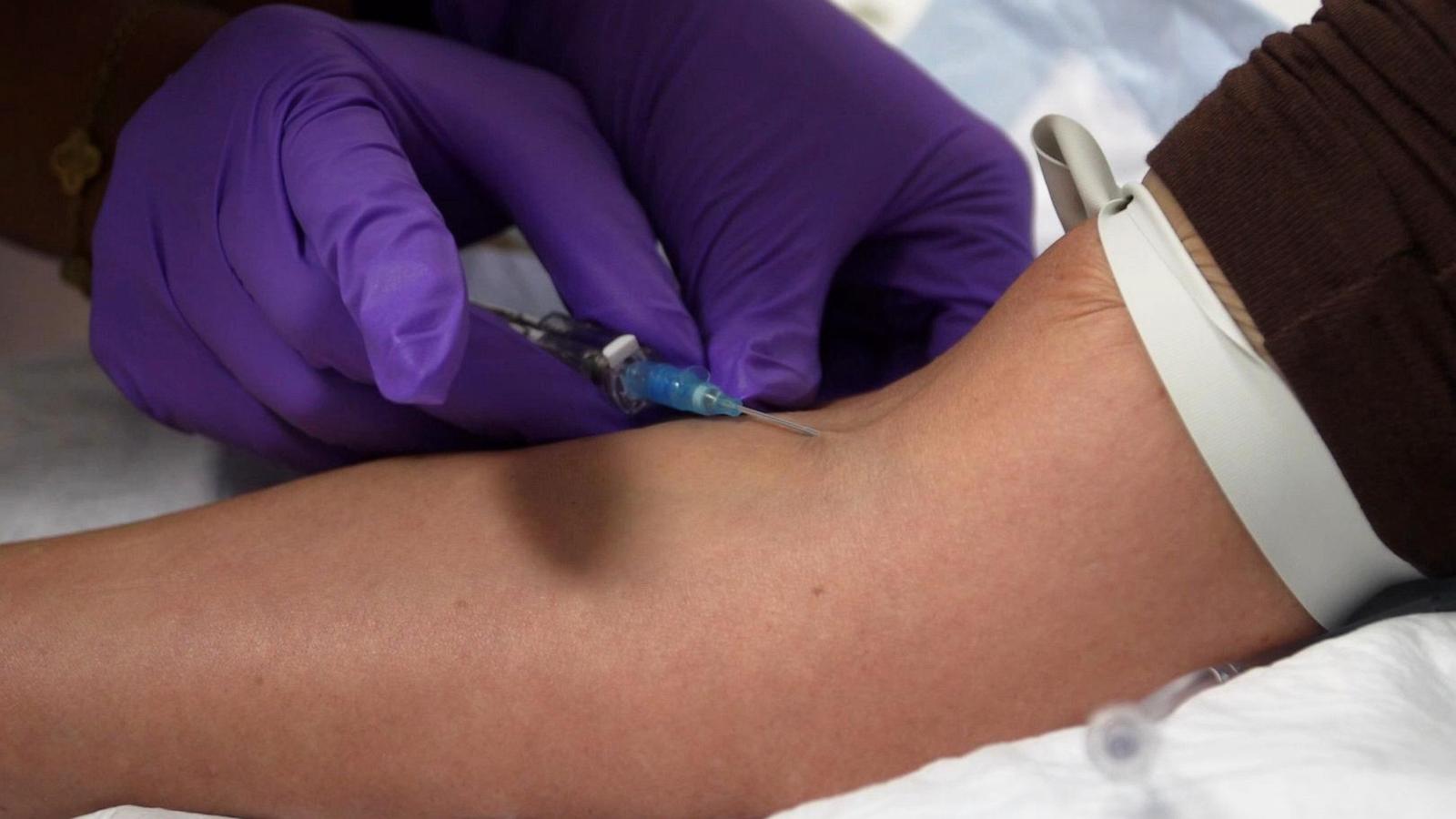 A closer look at the unapproved peptide injections promoted by influencers and celebrities