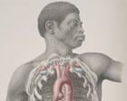 Anatomical exhibition includes rare Victorian-era drawing of a black body
