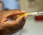 Controversial US study on hepatitis B vaccines in Africa is cancelled