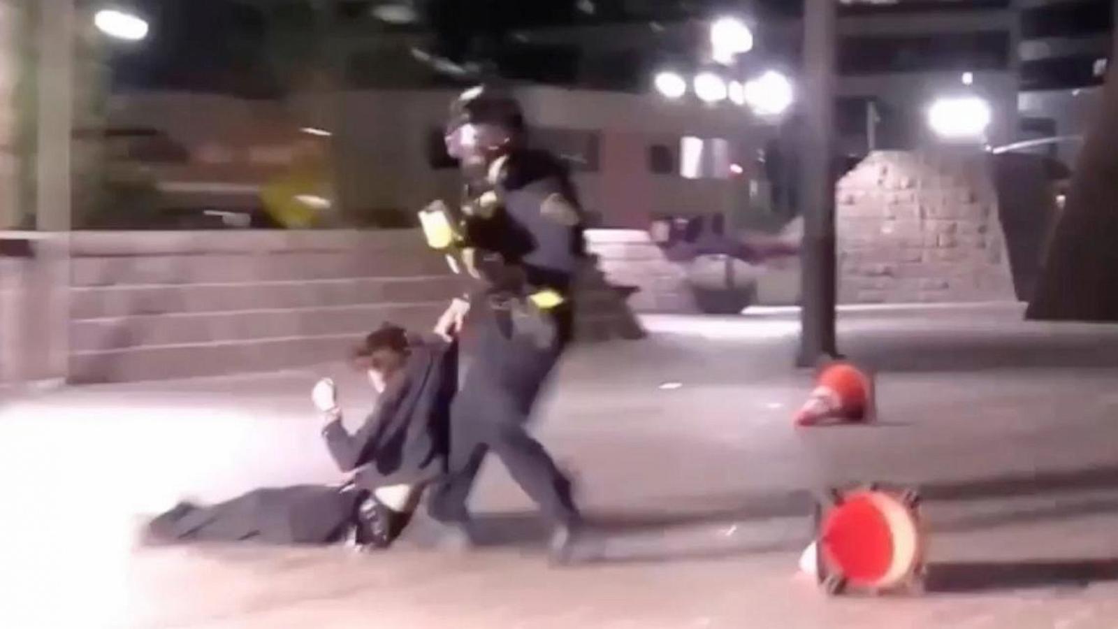 Demonstrator injured after federal agent fired projectile from close range during California protest