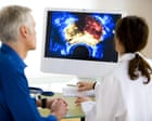 Most UK men should not be offered prostate cancer screening, experts say