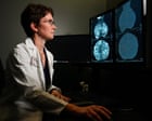 Groundbreaking genomic test could spare millions of breast cancer patients chemotherapy