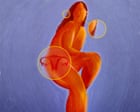 Can a name change transform PCOS outcomes for women? – podcast