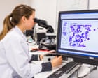Monday briefing: Are we any closer to a cure for cancer?