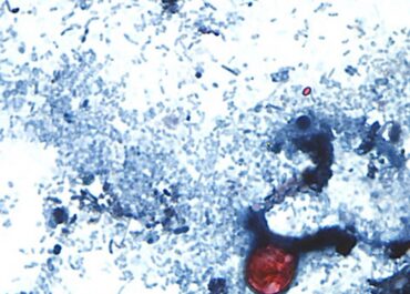 Taylor Farms recalls lettuce shipped to 27 states over cyclospora risk
