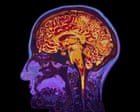 The incredible science of memory manipulation – podcast