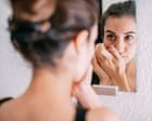 ‘Ferritin face’: are social media claims about iron deficiency fact – or fiction?